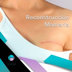 La reconstrucción mamaria en Guadalajara es una serie de cirugías que se realizan a pacientes de cáncer de mama, en cuyos casos fue necesario realizar una mastectomía (extirpación de una o ambas glándulas mamarias).