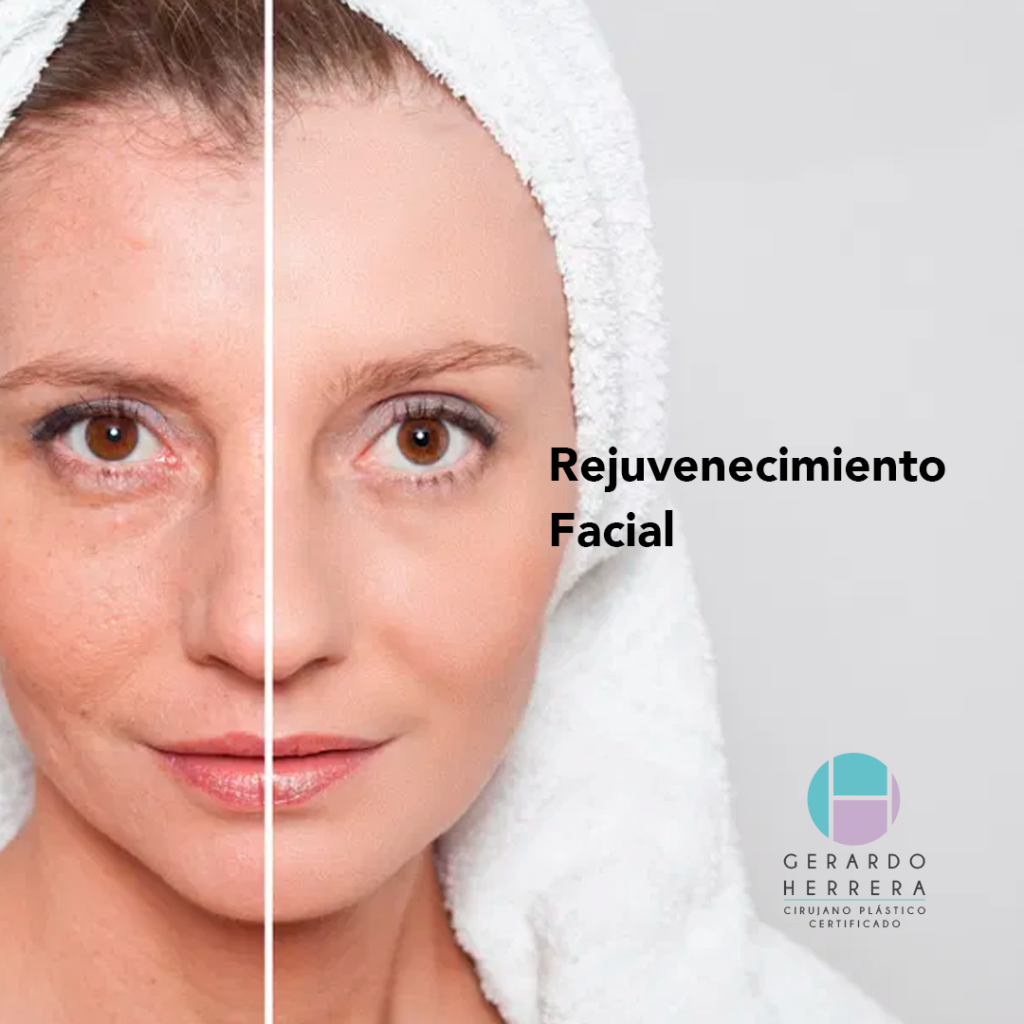 Rejuvenecimiento Facial en Guadalajara