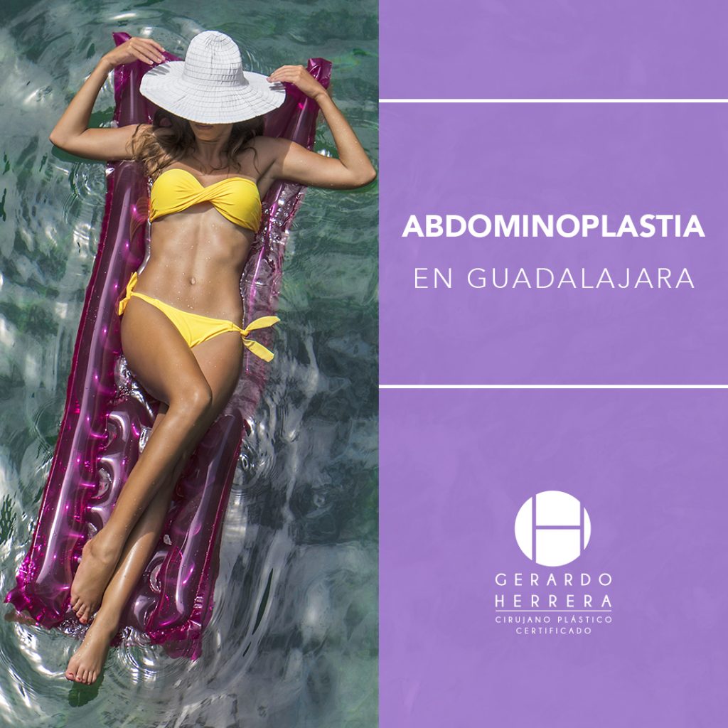 Abdominoplastia en Guadalajara