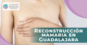 reconstrucción mamaria en Guadalajara