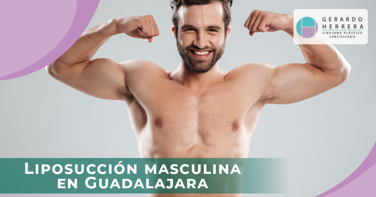 Liposucción masculina en Guadalajara: principales técnicas y recomendaciones médicas.