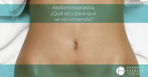 Abdominoplastia en Guadalajara.